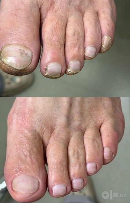 Педикюр без боли , выезд