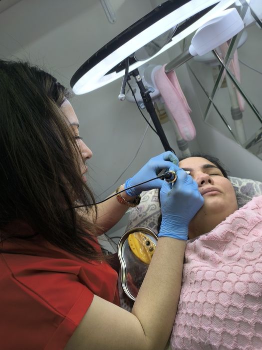 Красота это -губки бантиком на новый год! Botox full face