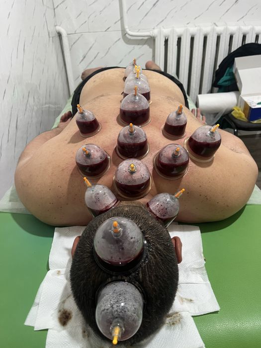 Хиджама и шертпе на выезд в городе Алматы