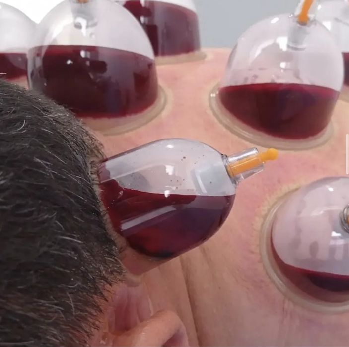 Хиджама в г.Актау