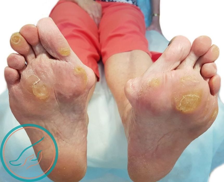 Проблемы с ногами (стопами) и ногтями