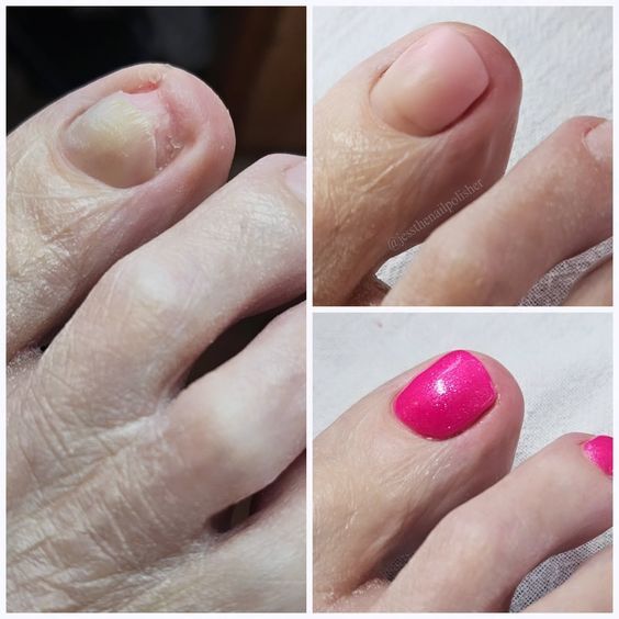 Подолог на выезд