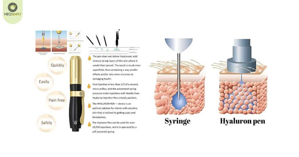 Инжектор Пен, нов, уголемяване на устни