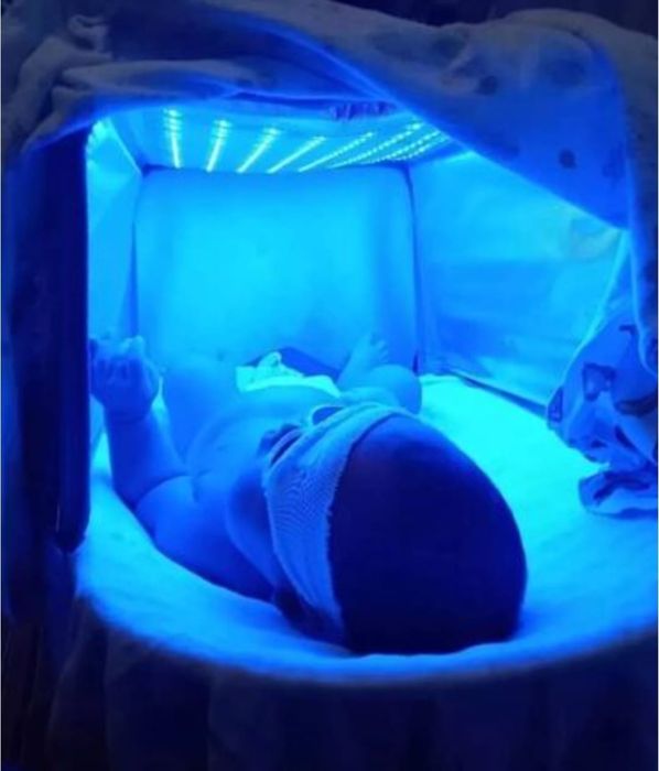 Фотолампа от желтухи