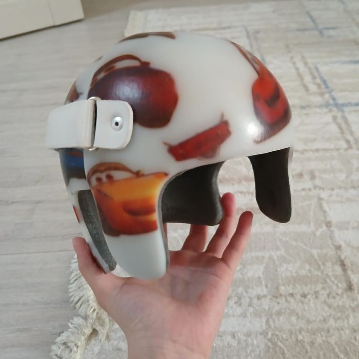 Ортопедический шлем