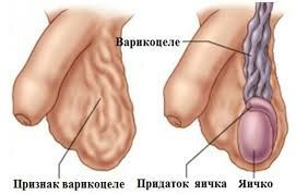 Шарики в половом члене