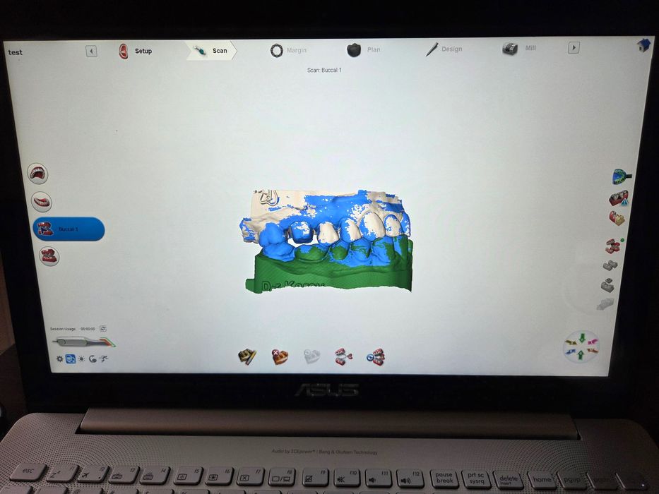 Интраорален скенер Planmeca PlanScan, 2450 EUR