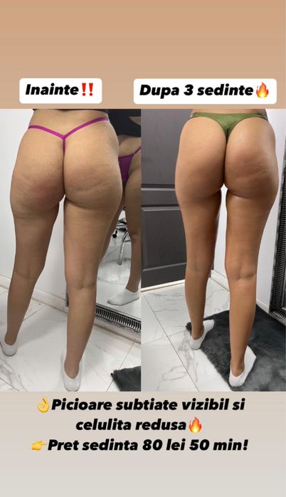 Masaj anticelulitic si remodelare corporala!