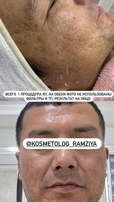Косметолог эстет для всех! Все виды косметологических услуг