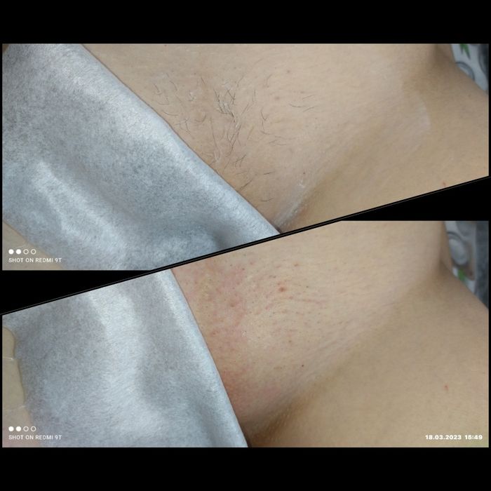 Шугаринг Усть-Каменогорск