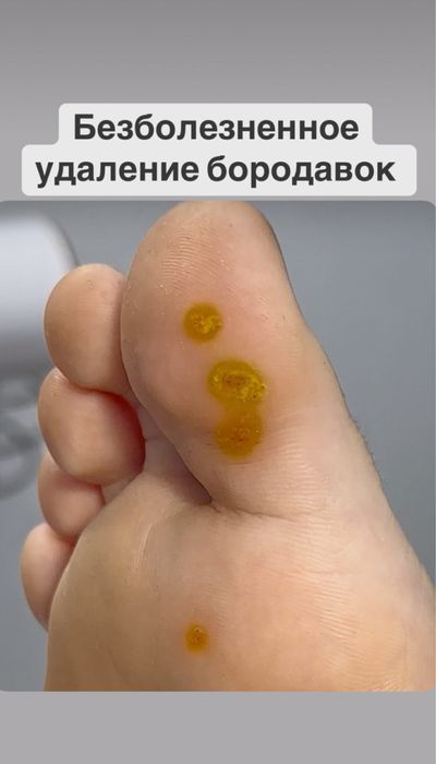 Услуги  подолога