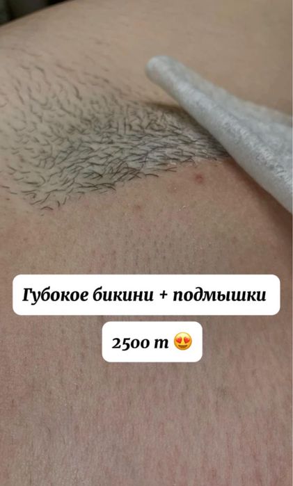 шугаринг по вызову