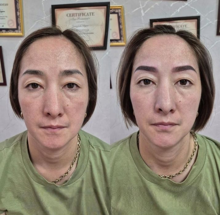 Действует только для женщин.