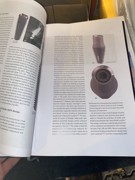 The Single-Tooth Implant J.Chu