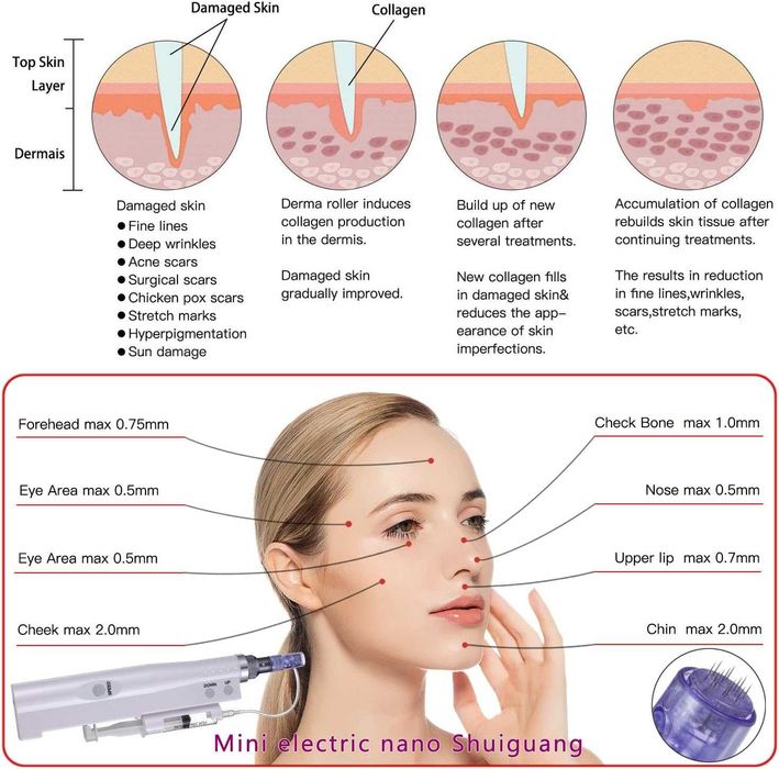 Професионален дерма пен за иглотерапия BOWKA