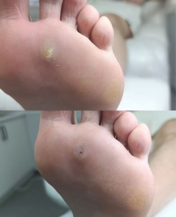 Педикюр на выезд