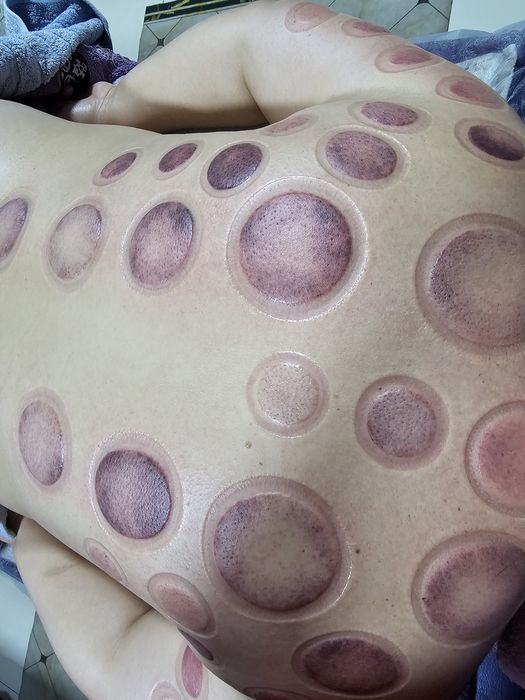 Медицинский лечебный массаж