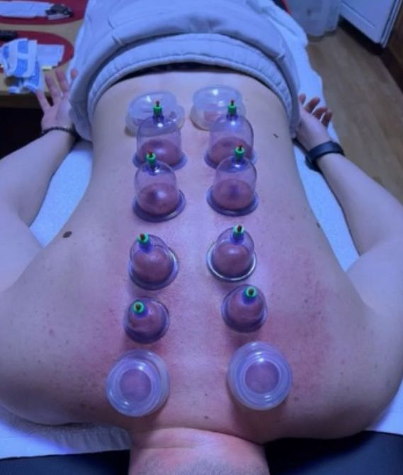 Masaj Terapeutic, Terapie Manuală & Ventuze | 4 ani experiență