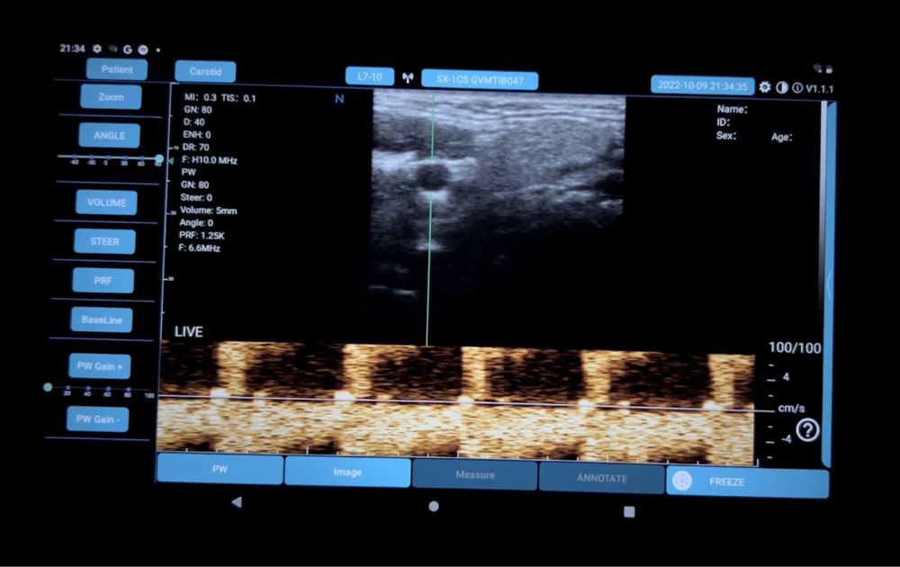 Портативен ехограф