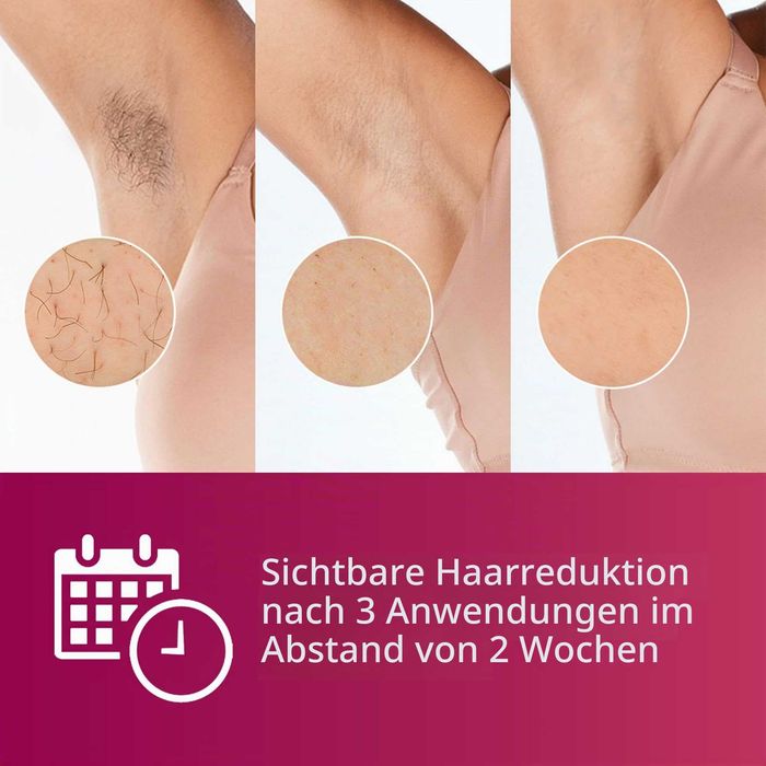 Фотоепилатор Philips Lumea Advanced BRI921/00 IPL