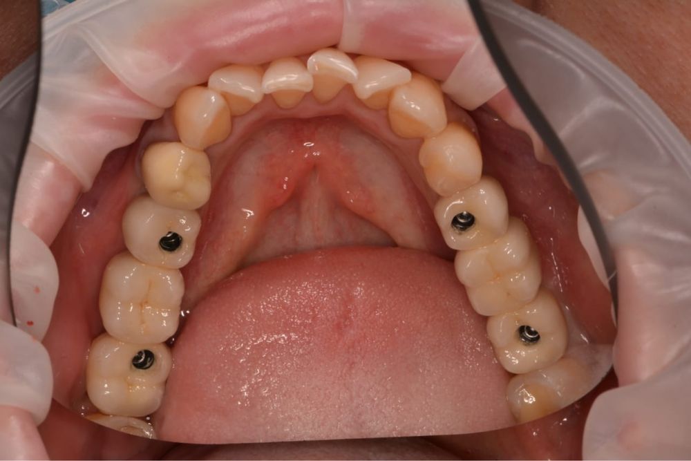 Услуги стоматолога ортопеда