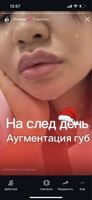 Аугмен губ 23900