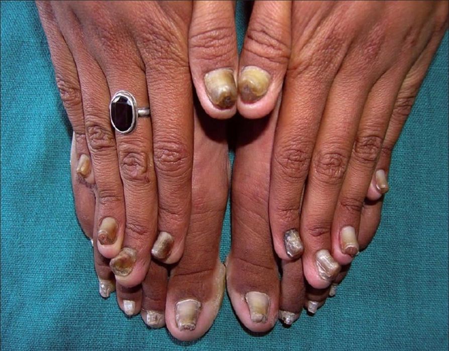 Проблемы с ногами (стопами) и ногтями