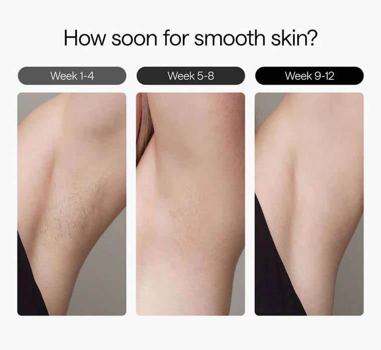 Фотоепилатор Ulike Air 3