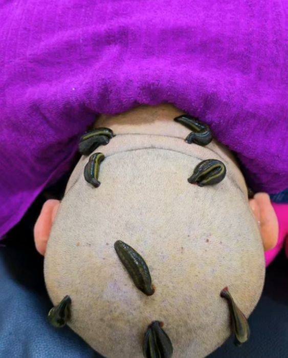 Xijoma va zuluk xizmati ( VIZIF )