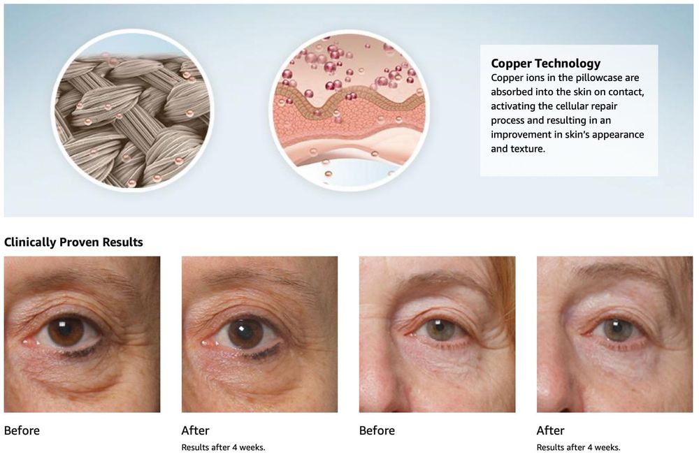 Ръкавици за подмладяване на кожата - Iluminage Skin Rejuvenating glove