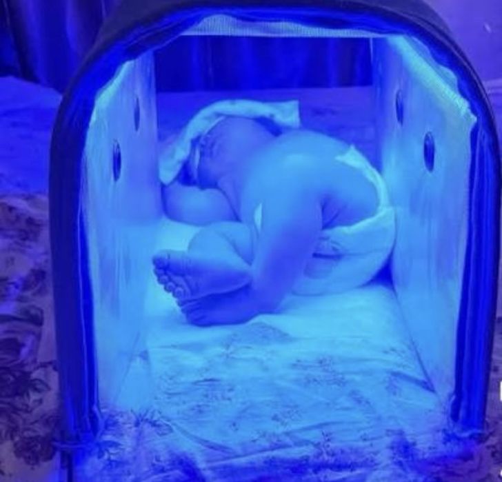 Фотолампа от желтушки