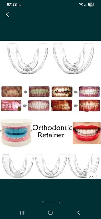 Ортодонтски коректор,шини,алайнер на зъби брекети зъбен фиксатор
Невид