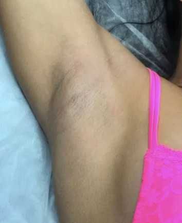 Депиляция, шугаринг без Боли ! Мастер ШУГАРИНГА, /локация КАРАСУ-1 /