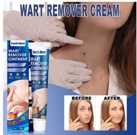 Крем за премахване на брадавици и мазоли