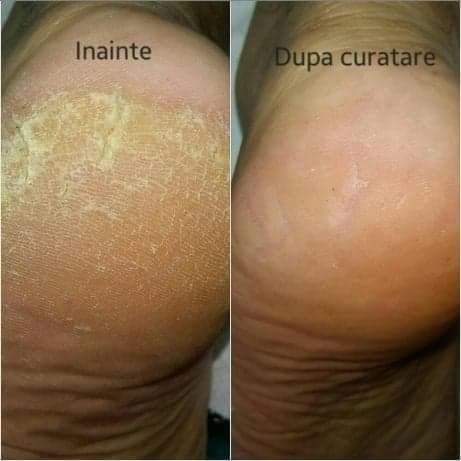 Pedichiura pentru seniori