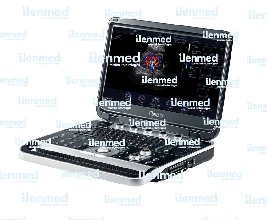 Портативная УЗИ система Finus 50 с цветным доплером