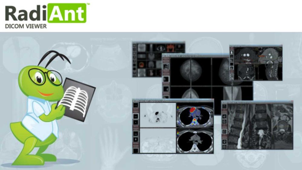 GAMMA Dental + OnDemand + Romexis + RadiAnt + SmileDesigner