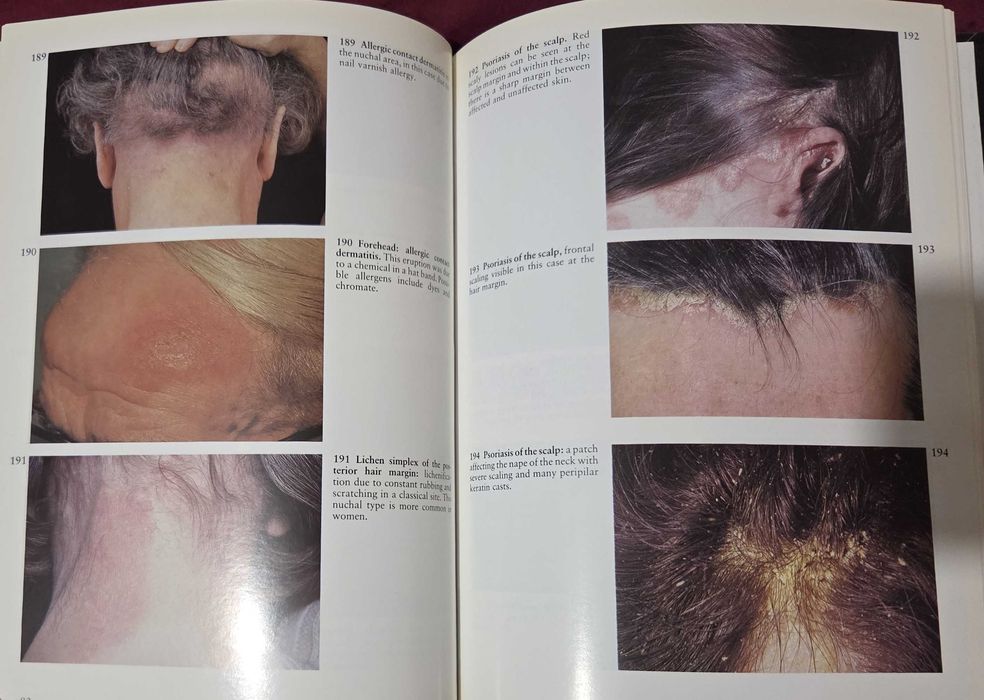 A Colour Atlas of the Hair, Scalp and Nails
