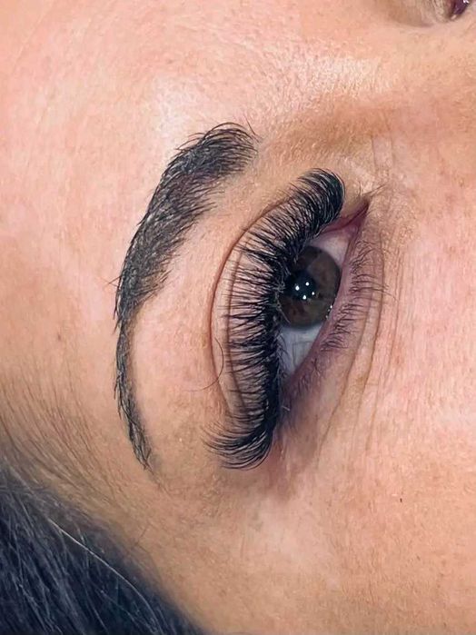 Миглопластика Перник