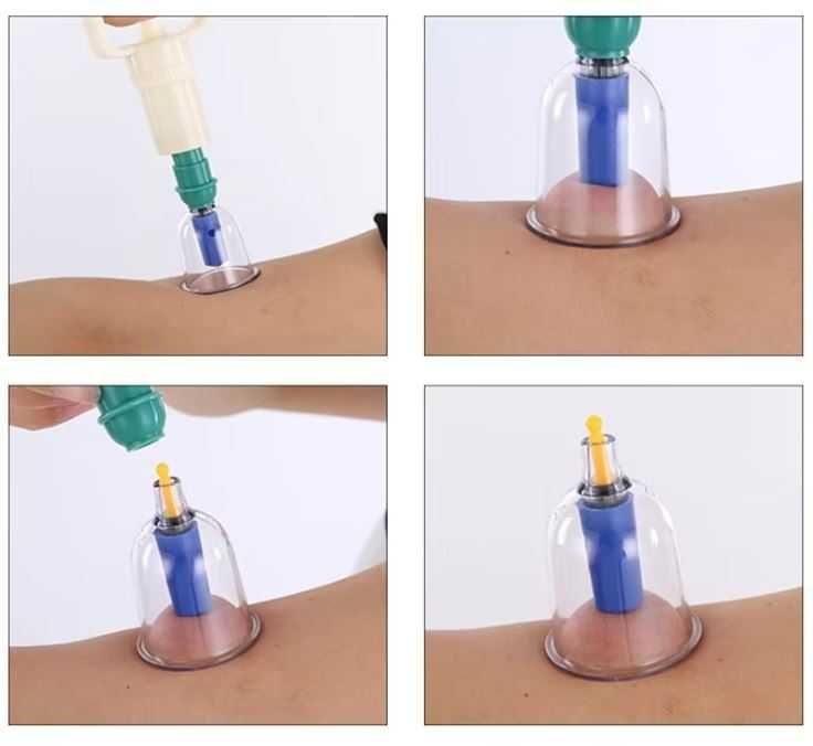 Професионален комплект вендузи, 32 броя + магнити и етерично масло