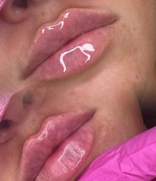 Акция на косметологические процедуры. Скидки до 50%