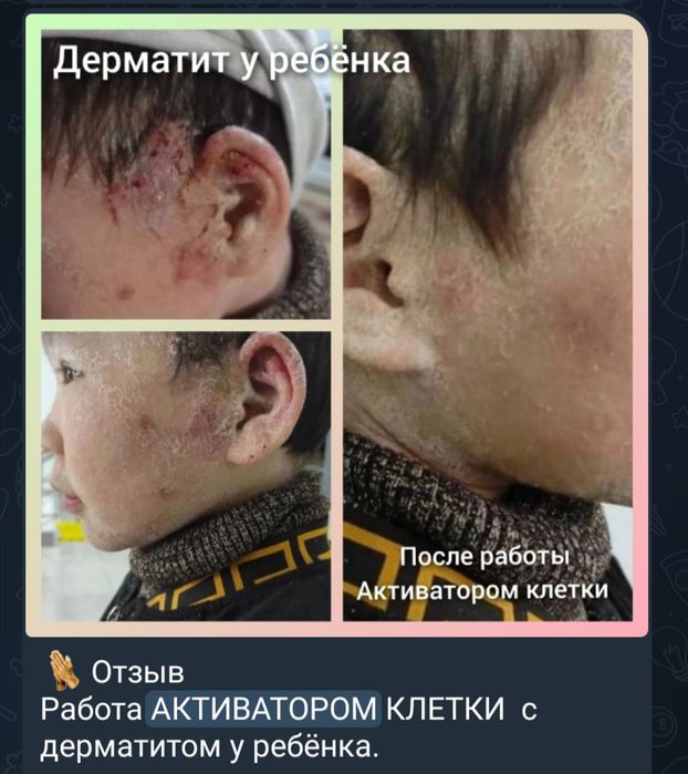 Продаётся Активатор Клеток