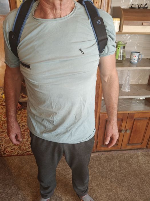 Клавикуларен бандаж при счупена ключица (Ортеза)