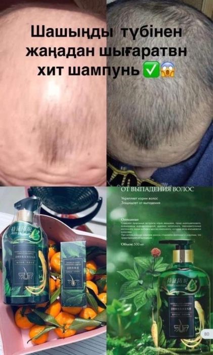 Шампунь от выпадения волос