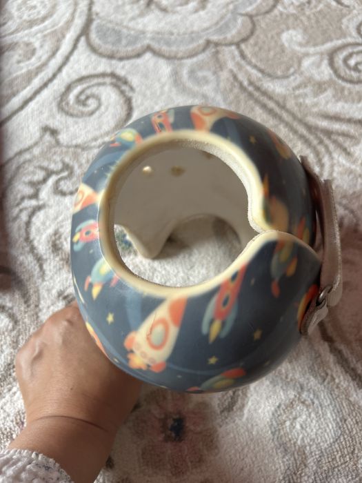 ортапедический шлем для лечения