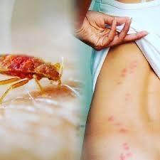 20% Скидка Дезенфекция дизенфекция дезинфекция дизинфекцияdizinfeksiya