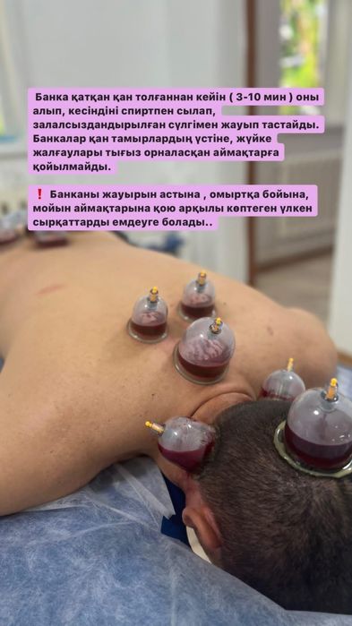 Хиджама Шымкент!!!