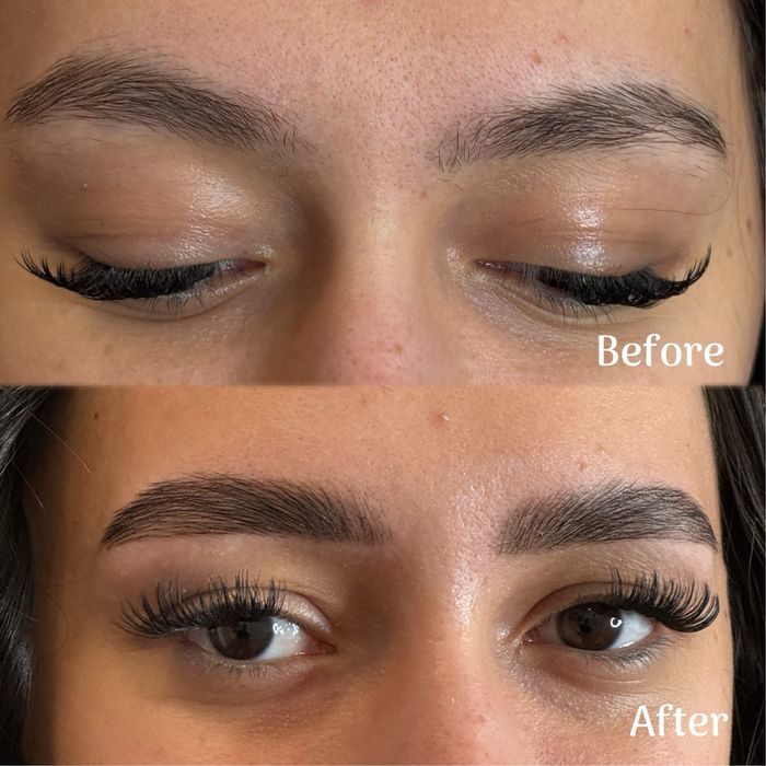 Laminare gene si sprancene