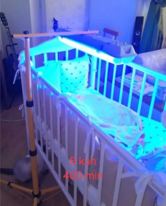 Фототерапия. Фотолампа. Желтушность у детей.