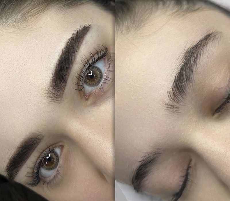 Kosmetologiya uxod Botokx Filler Lab Qosh xamma uxodla skidkada